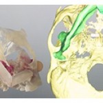 dreidimensionales Modell und Abbildung der virtuellen Planung einer Kieferrekonstruktion;